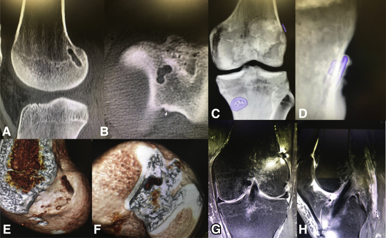 Fig 15