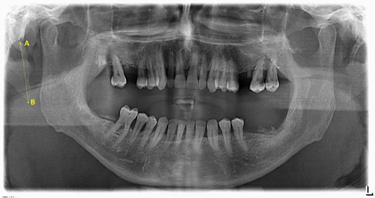 Fig. 2