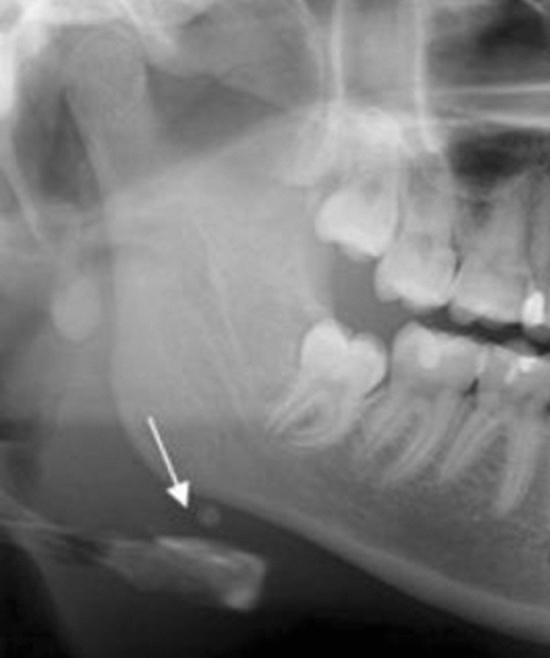 Fig. 5