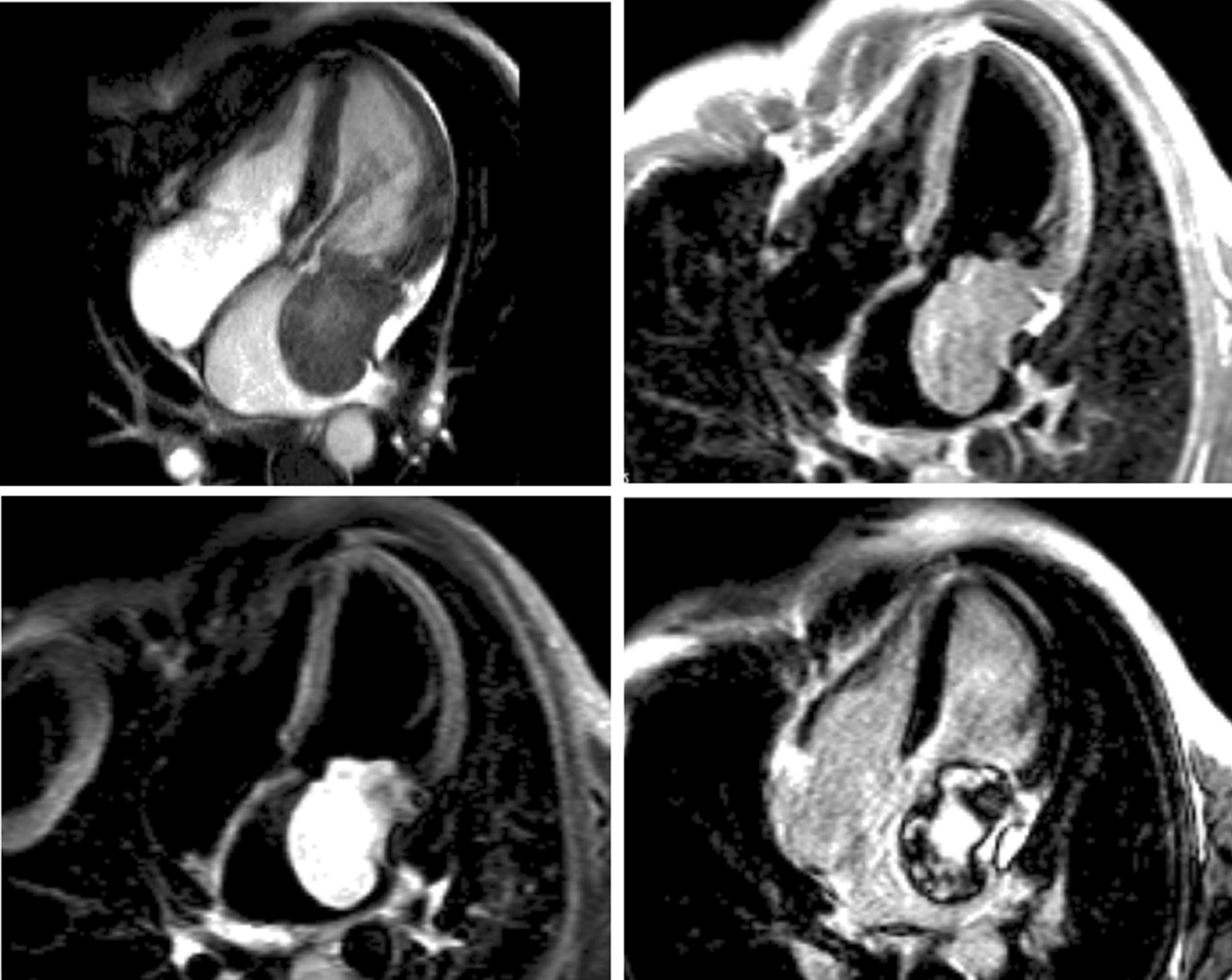 Fig. 12