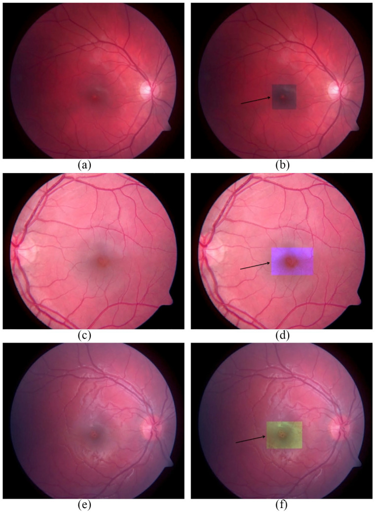 Figure 3.