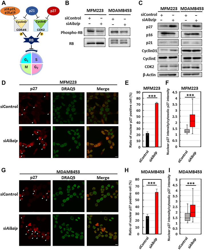 Figure 3. Depletion of AIbZIP promotes p27 upregulation and its translocation into the nucleus. A, Schema of important factors associated with G1-S–phase transition of cell cycle. B, Western blot analysis of RB and its phosphorylated form (Thr821/Thr826) in MFM223 and MDAMB453 cells transfected with Aibzip siRNA. C, Western blot analysis of p27, p16, p21, Cyclin D1, Cyclin E, and CDK2 in MFM223 and MDAMB453 cells transfected with Aibzip siRNA. D, Immunofluorescence staining of p27 in MFM223 cells transfected with Aibzip siRNA (p27: red, DRAQ5: green). Arrowheads indicate the cells which p27 was localized to the nucleus. Bar: 10 μm. E, Percentages of cells in which p27 was localized to the nucleus. (mean ± SD, n = 4). F, Ratio of nuclear p27 intensity divided by cytosolic p27 intensity (mean ± SD, siControl; n = 33 cells, siAibzip; n = 86 cells). Midline means median. G, Immunofluorescence staining of p27 in MDAMB453 cells transfected with Aibzip siRNA (p27: red, DRAQ5: green). Arrowheads indicate the cells with p27 localized to the nucleus. Bar: 10 μm. H, Percentages of cells in which p27 was localized to the nucleus (mean ± SD, n = 4). I, Ratio of nuclear p27 intensity divided by cytosolic p27 intensity (mean ± SD, siControl; n = 60 cells, siAibzip; n = 39 cells). Midline means median.