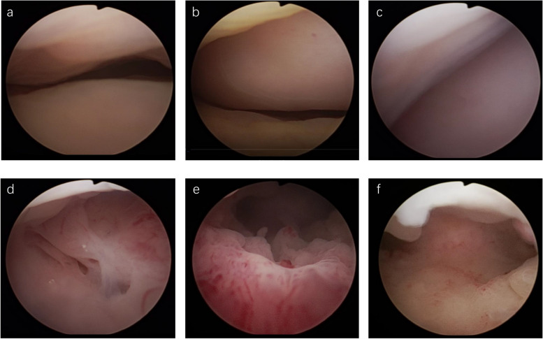 Fig. 1