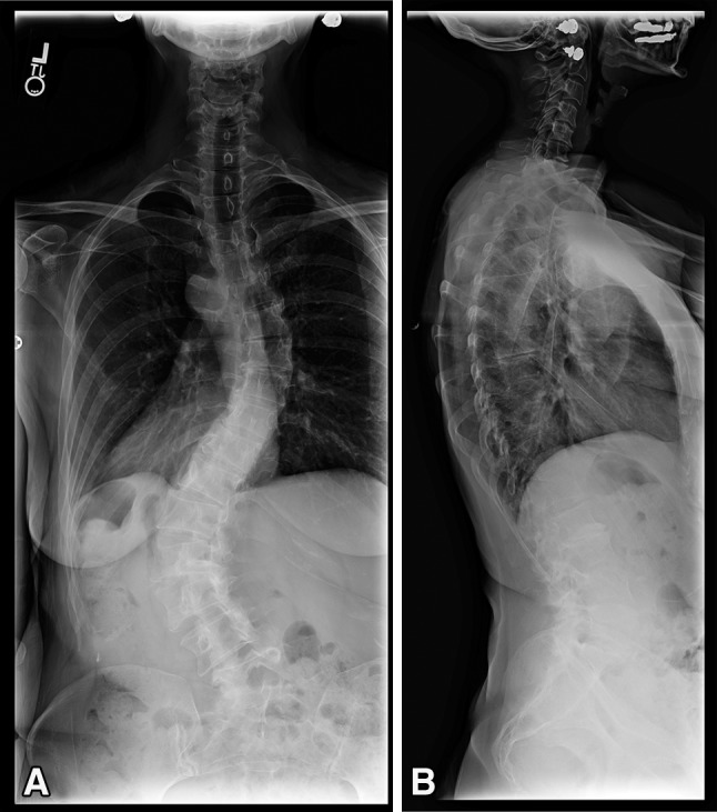 Fig. 1A–B