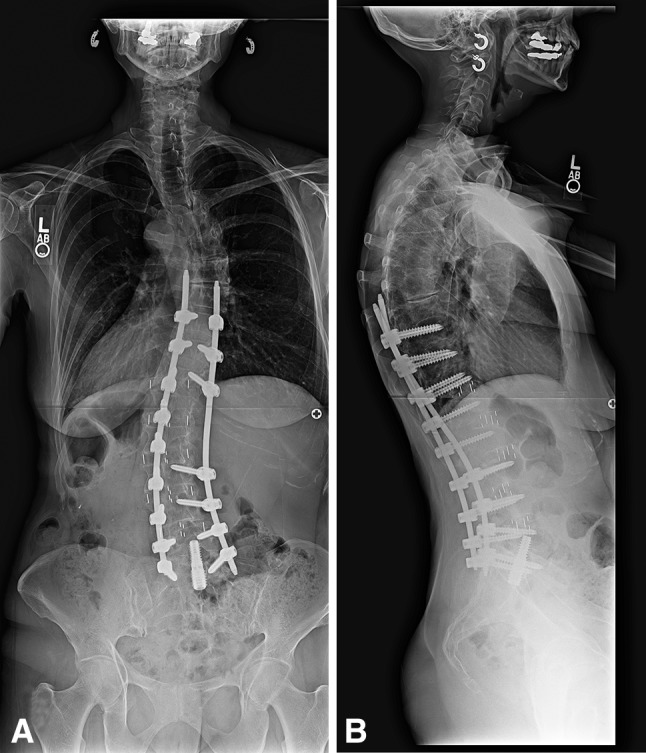 Fig. 2A–B