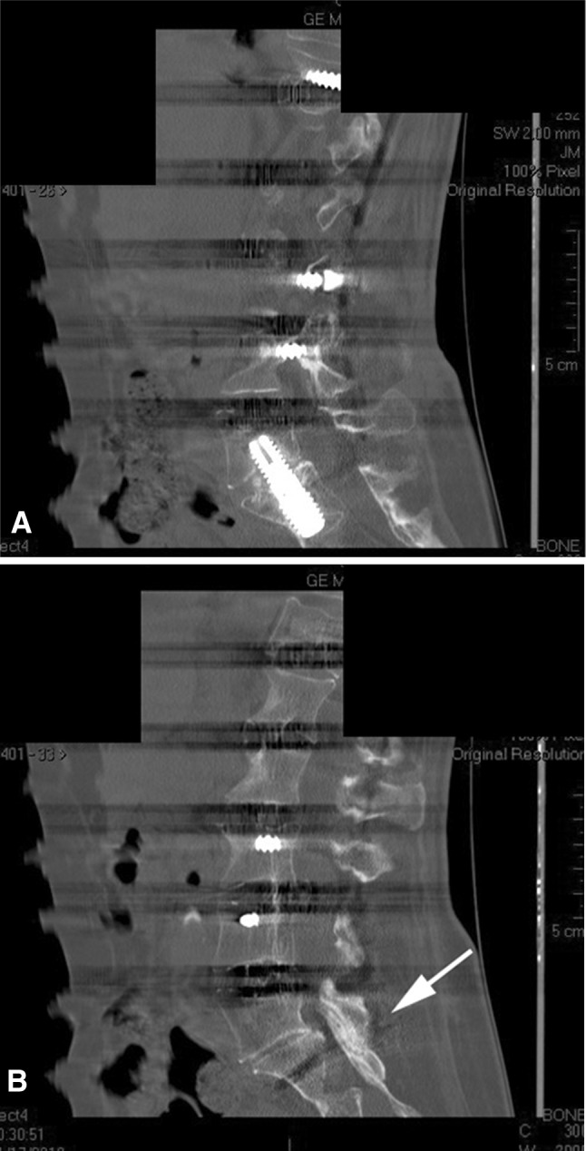 Fig. 3A–B