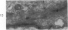 81