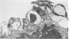 77