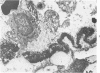 77
