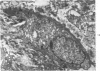 81
