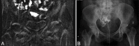 Figure 3 (A and B)