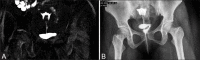 Figure 1 (A and B)