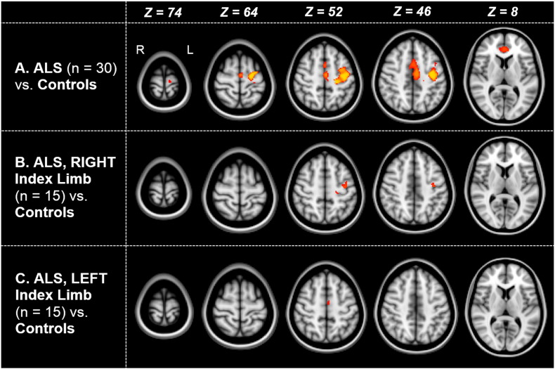 Fig. 1