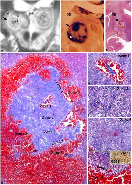 Fig.2