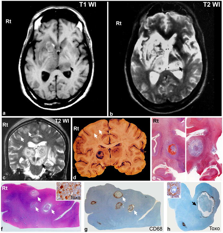 Fig 1