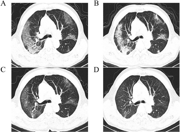 Fig 2