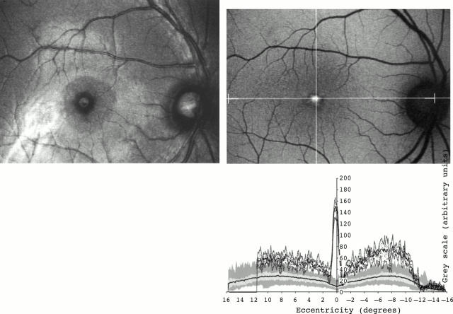 Figure 2  