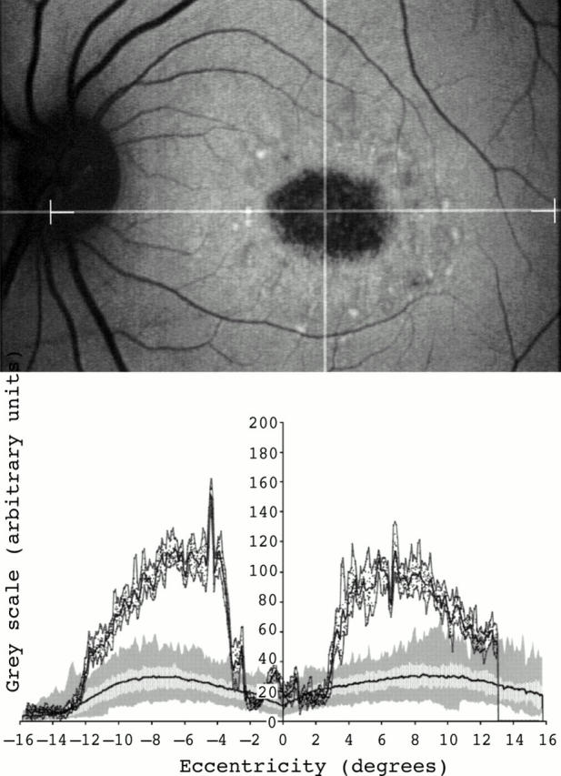 Figure 3  