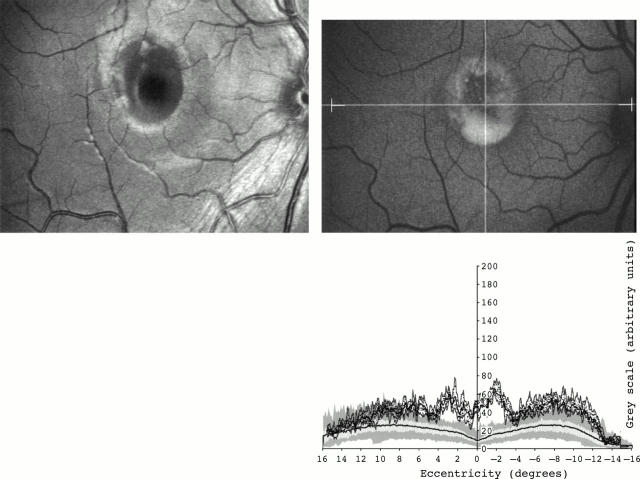 Figure 1  