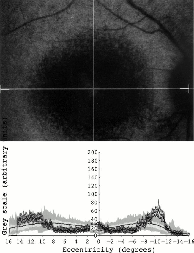 Figure 5  