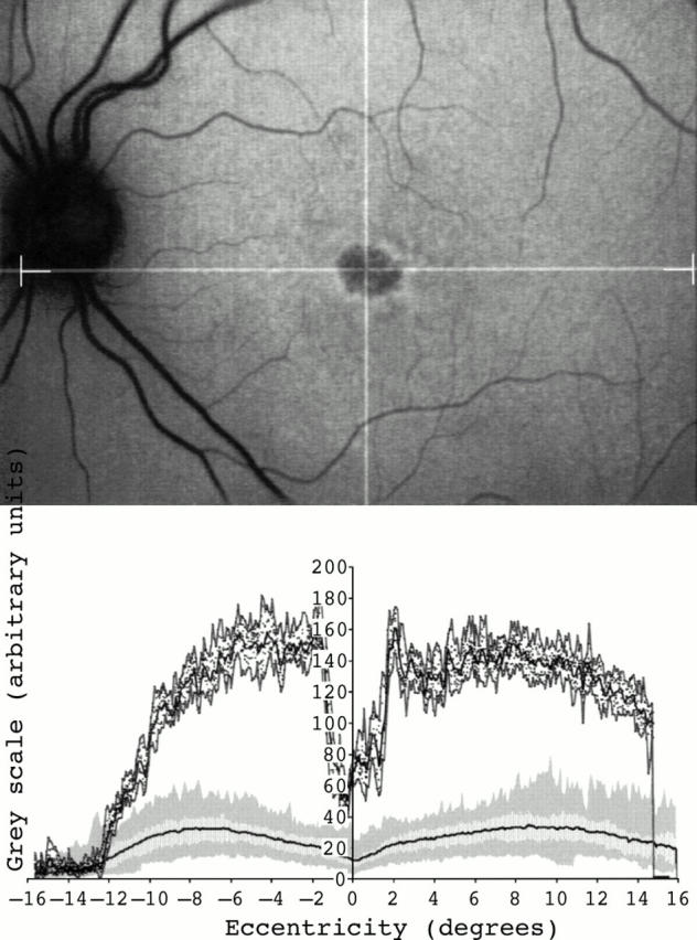 Figure 4  