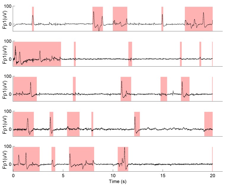 Fig 4