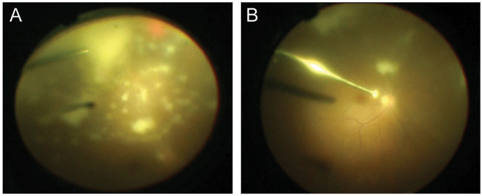 Fig. 3