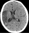 Fig. 1 –