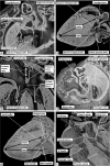 Fig 12