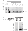Fig.4. Western blot analyses following immunoprecipitation: (A) Serum from the patient and a healthy subject