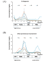 Fig.3. Profile of HPLC-GFC analyses at the diagnosis (A) and after the spontaneous improvement (B)