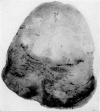 84-2