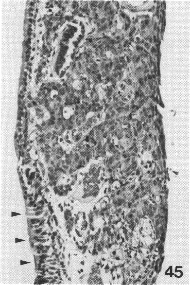 PLATE 45.