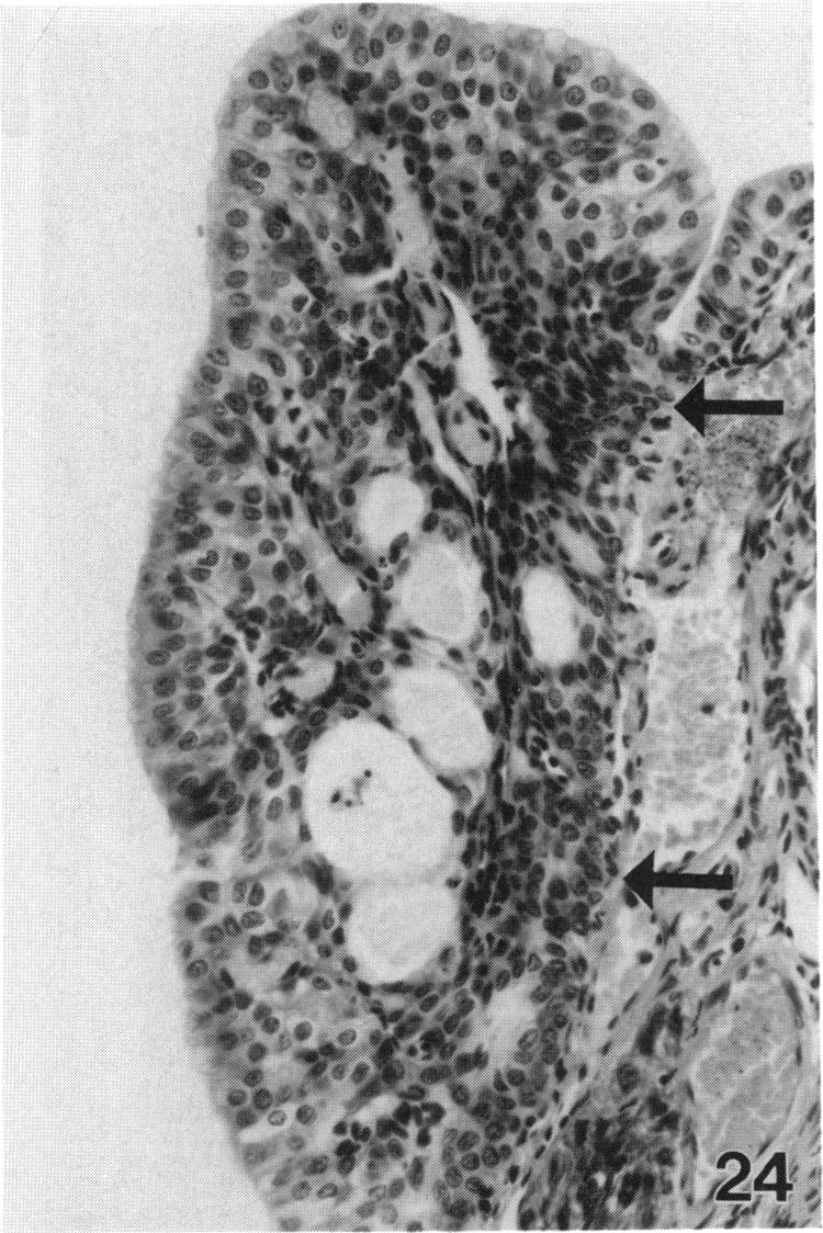 PLATE 24.