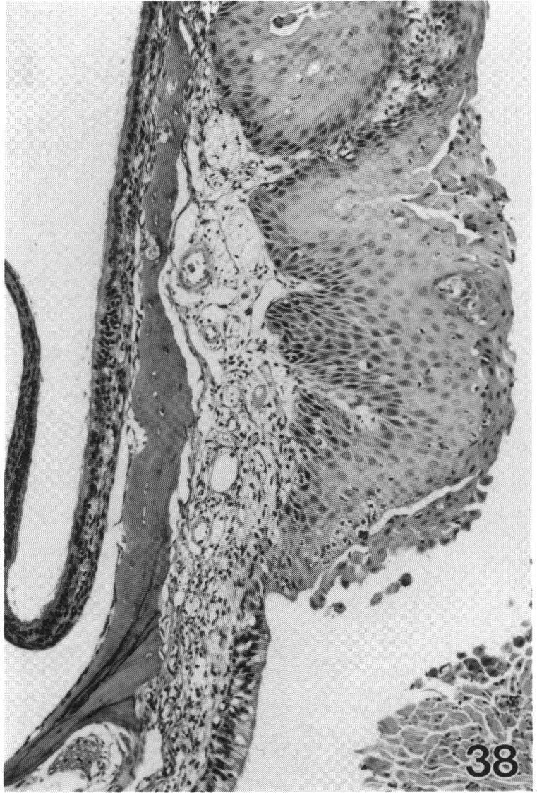 PLATE 38.