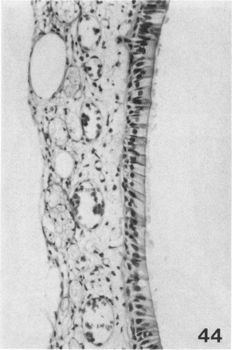 PLATE 44.