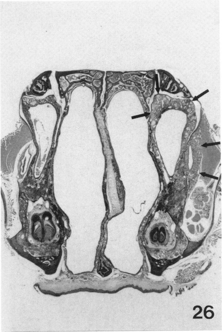 PLATE 26.