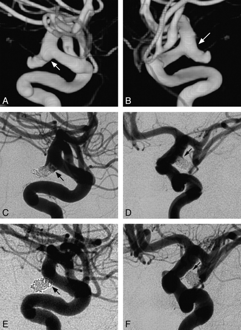 Fig 2.