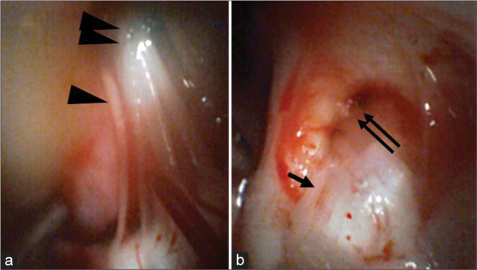 Figure 2: