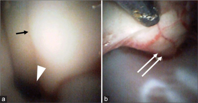 Figure 3: