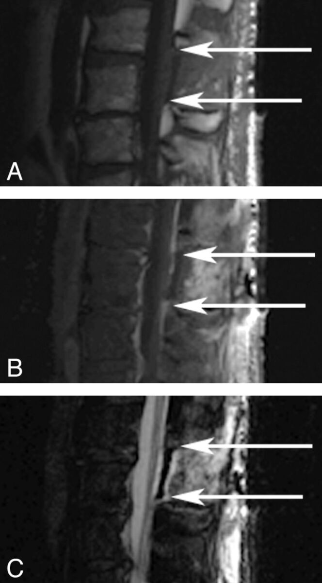 Fig 3.