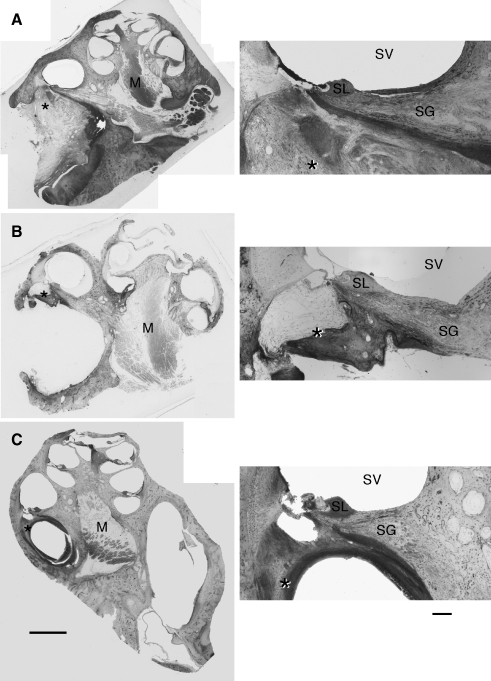 FIG. 5