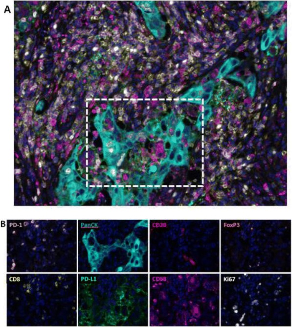 Fig. 1 (abstract P433).