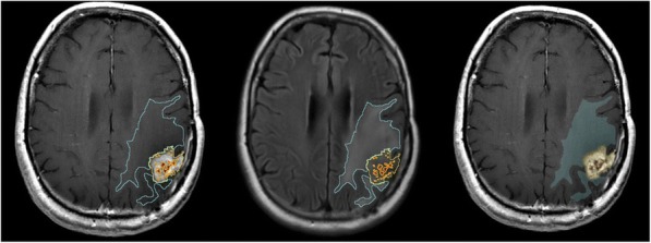 Fig. 2 (abstract P431).