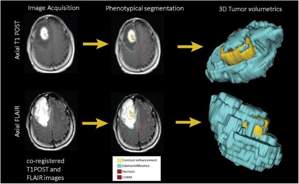 Fig. 1 (abstract P432).