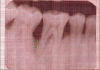 Figure 1a