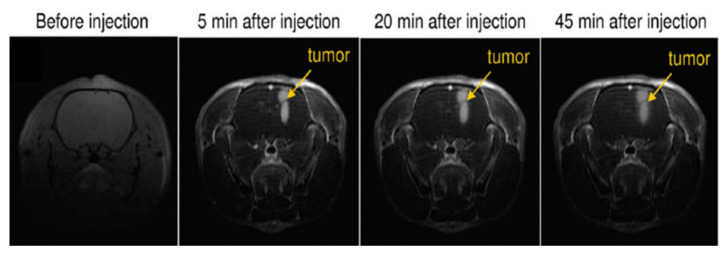 Figure 14