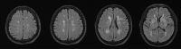 Fig. 5