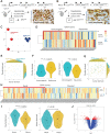 Figure 1. Comparison of ductal and acinar cell–derived tumor signatures to human molecular subtypes of PDAC. A and B, Schematic of the transgenic mouse breeding scheme to generate mutant Kras and Tp53 tumors from acinar and ductal cells and IHC analysis of CK19 to show ductal adenocarcinoma arising in ductal and acinar mouse models of PDAC. C, PCA of KPCDuct and KPCAcinar RNA-seq samples. Tumors arising in ductal and acinar cells have distinct profiles. D, Heat map shows the GSVA scores for human homolog genes derived from mouse ductal and acinar signatures in different samples from ICGC immunogenic and squamous subtypes. The color represents the relative GSVA score. E, Scatter plot of the GSVA scores for human homolog genes derived from mouse ductal and acinar signature genes in ICGC immunogenic and squamous subtypes. F, Violin plot of the GSVA scores for human homolog genes derived from mouse ductal and acinar signature genes in ICGC immunogenic and squamous subtypes. G, Scatter plot of the GSVA scores for human homolog genes derived from mouse ductal and acinar signature genes in TCGA basal and classic subtypes. The big round dots represent the medium of the GSVA scores, while the small round dots represent the score for each sample. We used a nonparametric Wilcoxon rank sum test for both groups. *, P < 0.05; **, P < 0.01. H, Heat map shows the GSVA scores for human homolog genes derived from mouse ductal and acinar signatures in different samples from TCGA basal and classic subtypes. I, Violin plot of the GSVA scores for human homolog genes derived from mouse ductal and acinar signature genes in TCGA basal and classic subtypes. J, Volcano plot showing distinct transcriptomic signatures in the duct and acinar tumors.