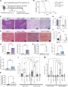 Figure 4. Inhibition of CD73 using intraperitoneal delivery of APCP significantly reduces spontaneous aggressive ductal-derived PDAC. A, Schematic of the preclinical model to evaluate the requirement for CD73 in a spontaneous GEM model of ductal-derived PDAC. B, APCP significantly improved survival only in KCDuct GEM mice (n = 5 mice per group). C, Representative H&Es of vehicle-treated compared with APCP-treated KCDuct and KCAcinar pancreata. D, Inhibition of CD73 significantly reduced PDAC area in KCDuct (n = 2) compared with control (n = 3) but not KCAcinar GEM mice (n = 2) compared with control (n = 2) (****, P < 0.0001; ***, P < 0.001; **, P < 0.01). E, Trichrome images showing PDAC areas in KCDuct and KCAcinar GEM mice in both vehicle and APCP-treated groups. F, APCP treatment significantly reduced the percentage of collagen in both KCDuct and KCAcinar pancreata. A two-way ANOVA was used to compare groups. G, Quantification of multiplex immunofluorescent analysis of %CD8+ cells or %CD8+GZM+ cells per whole tissue on the section from KCDuct Ctrl- and APCP-treated mice (n = 3). H, Spatial quantification showing a significant increase in CD8+GZM+ cells within 80 μm radius of CD19+ cells in APCP-treated KCDuct pancreata compared with Ctrl KCDuct (*, P < 0.05; n = 3). I, Quantification of multiplex immunofluorescent analysis of %CD8+ cells or (J) %CD8+GZM+ cells per field in pancreata from KCAcinar Ctrl- and APCP-treated mice (n = 3). K, Spatial quantification showing an increase in CD8+GZM+ cells within 80 μm radius of CD19+ cells in APCP-treated KCAcinar pancreata compared with Ctrl KCAcinar (ns; n = 3). L and M, Quantification of %CD73+ cells per cell type in Ctrl versus APCP-treated samples. In KCDuct, but not KCAcinar, we quantified a 2-fold increase in CD73+CD8+ T cells, 1.5-fold increase in CD73+CD8+GZM+ T cells, and a 4-fold increase in CD73+ epithelium in pancreata from APCP-treated mice (n = 3).